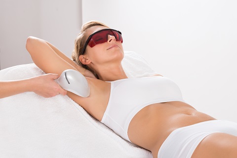 Female Laser Hair Removal